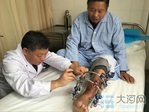 河南“拉皮”技术在全国属于首家 瞅瞅有多牛