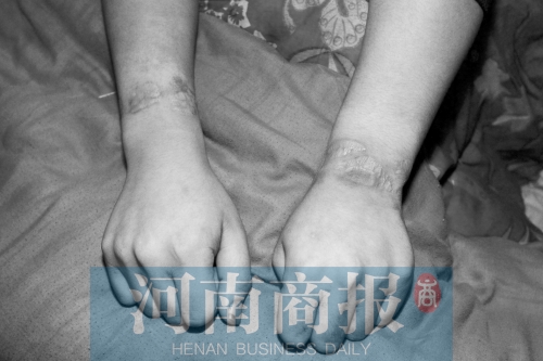 登封20岁男孩因患病 被亲生父母用铁链锁住447天