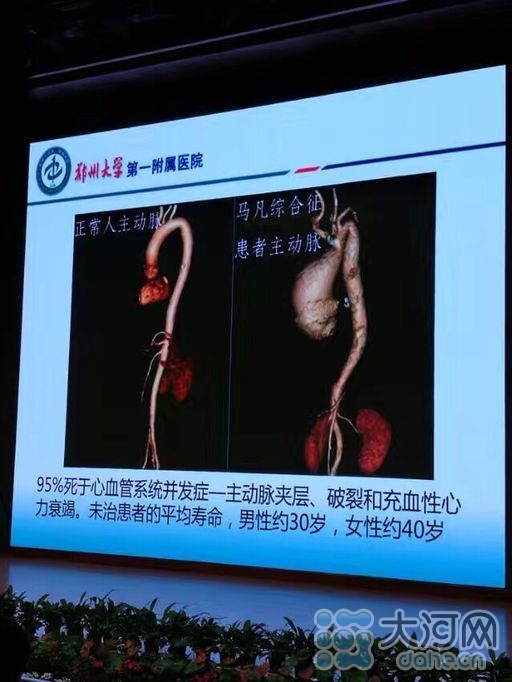 国内首家遗传性心血管防治及生殖指导中心在河南成立