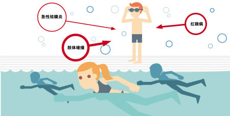 游泳季红眼病高发 专家提醒注意预防
