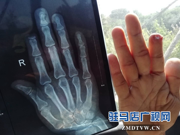 确山县三里河北岗易地扶贫搬迁安置项目存在安全隐患