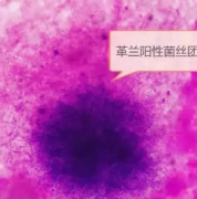 慌了！男子摸了出土文物后反复住院七次！