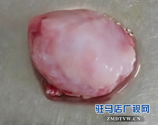 追寻脖颈里的“人体玛瑙”