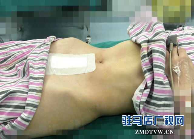 以为“三胎”之喜 不料肿瘤来袭
