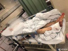 母女小区内遭4条狗围攻，女儿：狗主人看着我们被咬