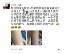 广东一幼儿园保育员别针扎幼儿 警方：已刑事强制