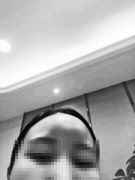郑州一女大学生整形失败额头变“南极翁” 涉事医院拒其索赔