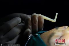中国跻身全球第三大医美市场，投诉3年上升10倍多