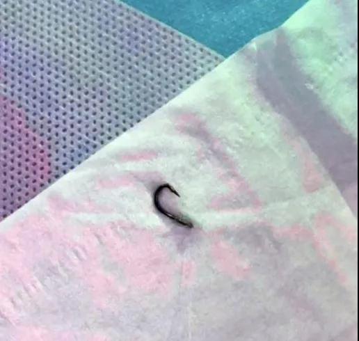 惊险！驻马店一男子吃面条吃进一个鱼钩！