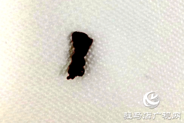 34岁突发脑梗塞 市县联动40分钟挽救生命