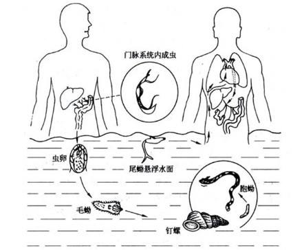 汛期严防急性血吸虫病