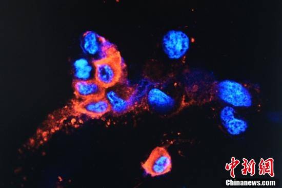 “奥密克戎”长这样！