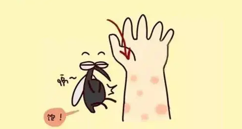 蚊子包越大，毒性越大？学会这几招让它退！退！退！