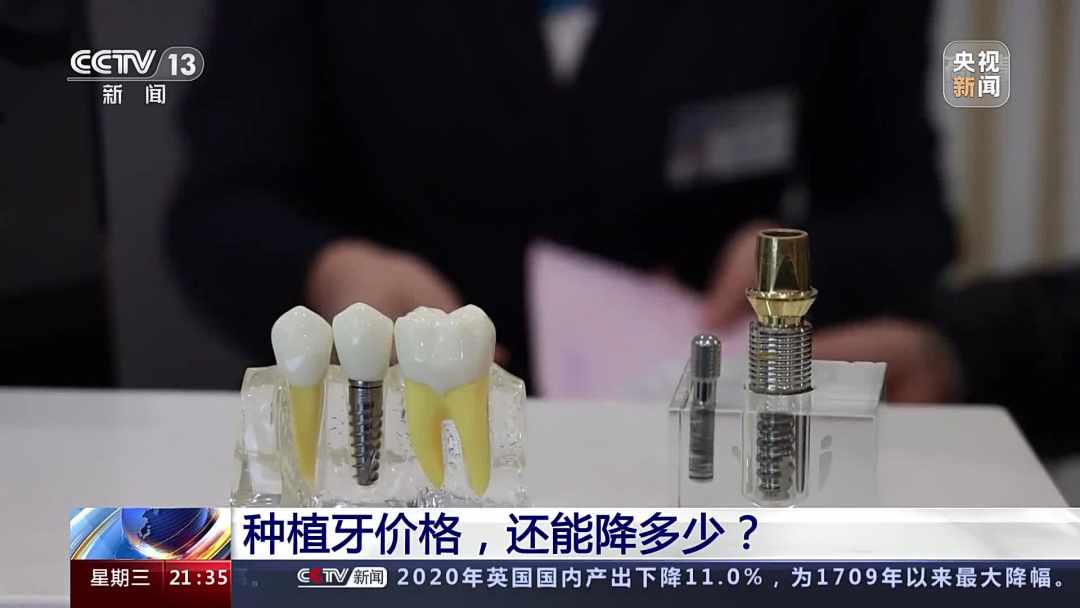 种植牙价格，还能降多少？