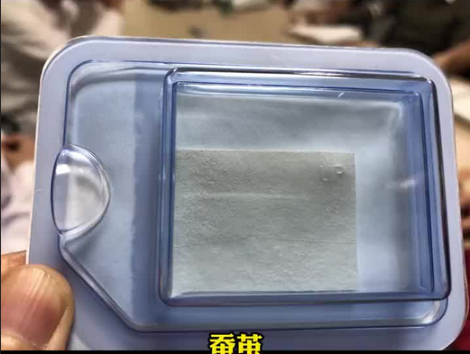 全球首次：专家成功将蚕茧提取物替代种植牙耗材