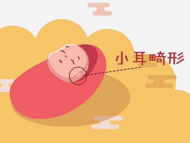  “慈善救助耳廓畸形”项目定点遂平县妇幼保健医院