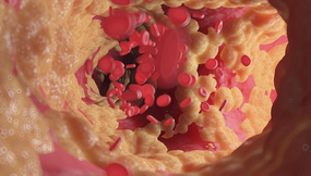 5个不起眼的生活习惯，正在伤害你的血管！
