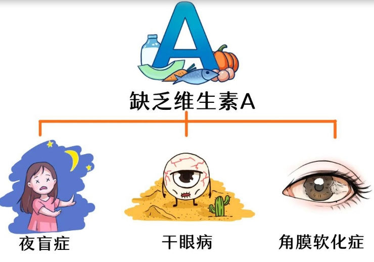 @近视的你 当心甜食正在悄悄损害你的视力