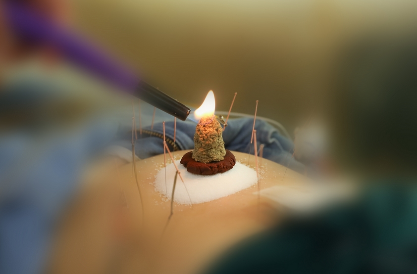 &ldquo;冬病夏治&rdquo;正当时 医院三伏贴灸活动火热开启